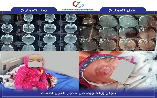 أخبار من قسم جراحة المخ والأعصاب>>